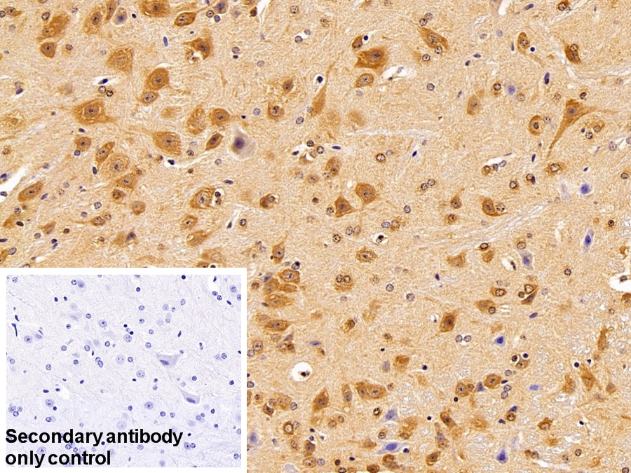 Polyclonal Antibody to Heat Shock 70kDa Protein 1B (HSPA1B)