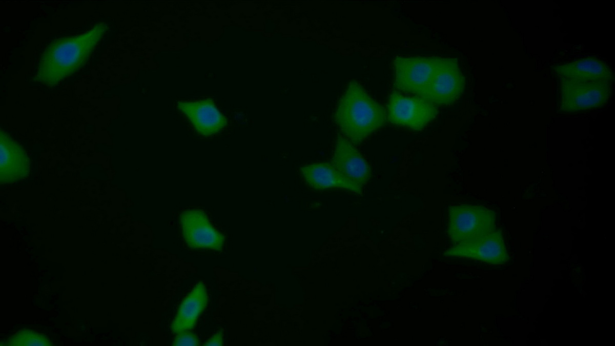 Polyclonal Antibody to Galectin 3 (GAL3)