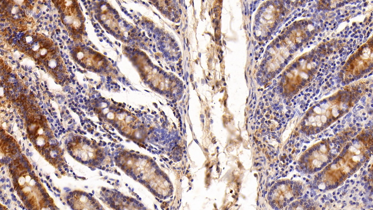 Polyclonal Antibody to Galectin 3 (GAL3)