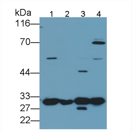 Polyclonal Antibody to Galectin 3 (GAL3)