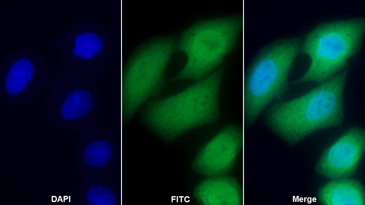 Polyclonal Antibody to Galectin 3 (GAL3)