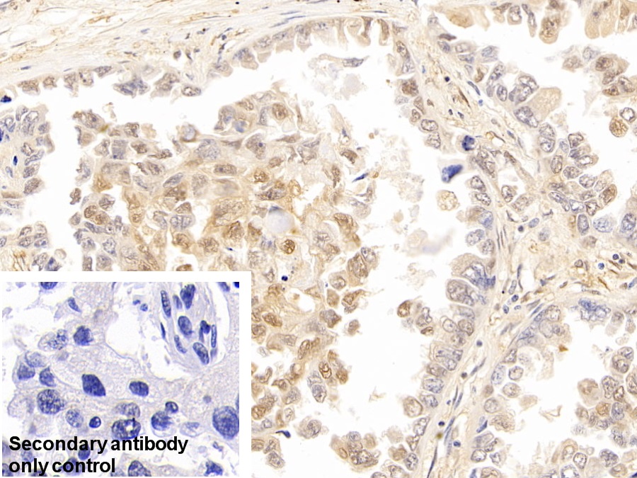 Polyclonal Antibody to Galectin 3 (GAL3)