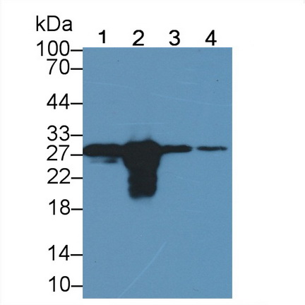 Polyclonal Antibody to Galectin 3 (GAL3)