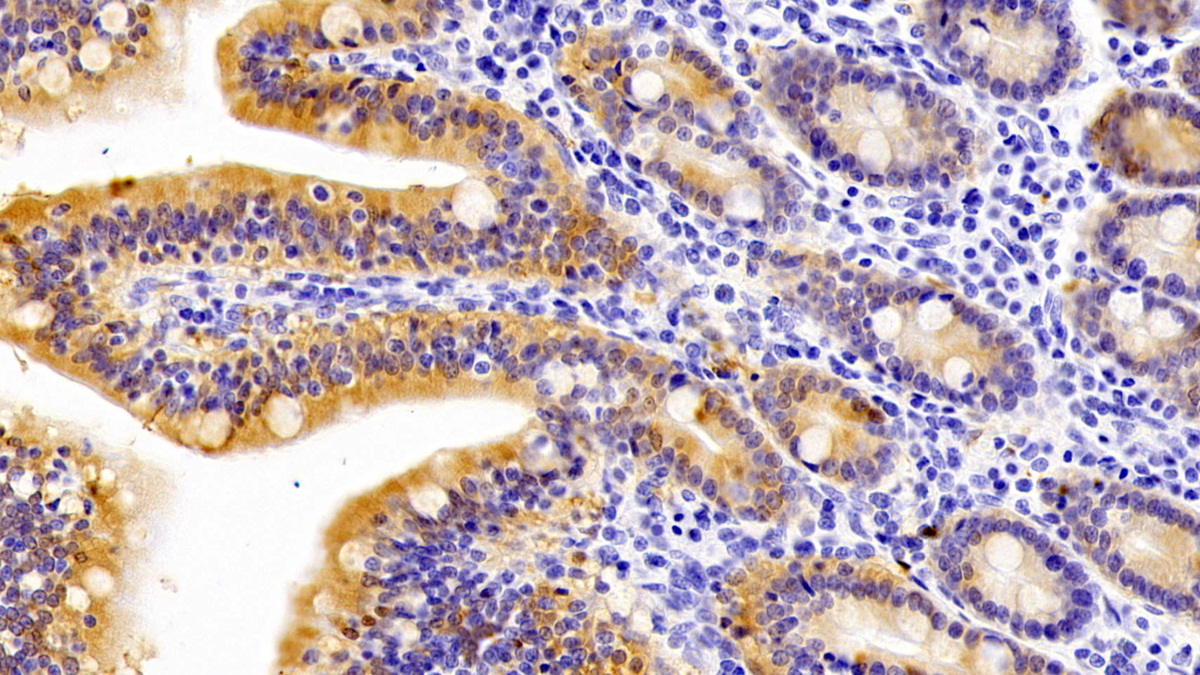 Polyclonal Antibody to Galectin 4 (GAL4)