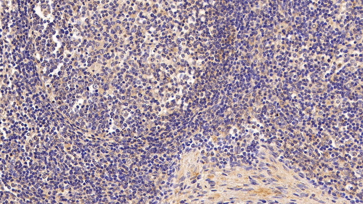 Polyclonal Antibody to Thyroxine Binding Globulin (TBG)