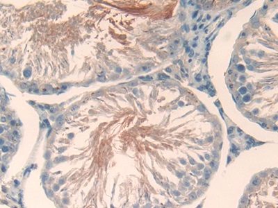 Polyclonal Antibody to Thyroxine Binding Globulin (TBG)