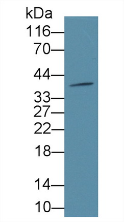 Polyclonal Antibody to Cathepsin L (CTSL)