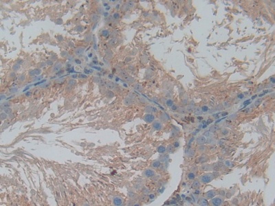 Polyclonal Antibody to Cathepsin L (CTSL)