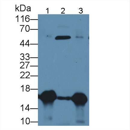 Polyclonal Antibody to Galectin 7 (GAL7)