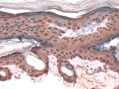 Polyclonal Antibody to Galectin 7 (GAL7)