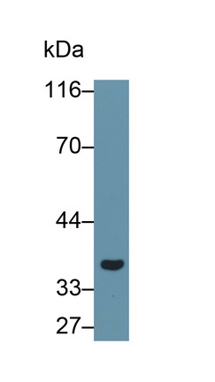 Polyclonal Antibody to Galectin 8 (GAL8)