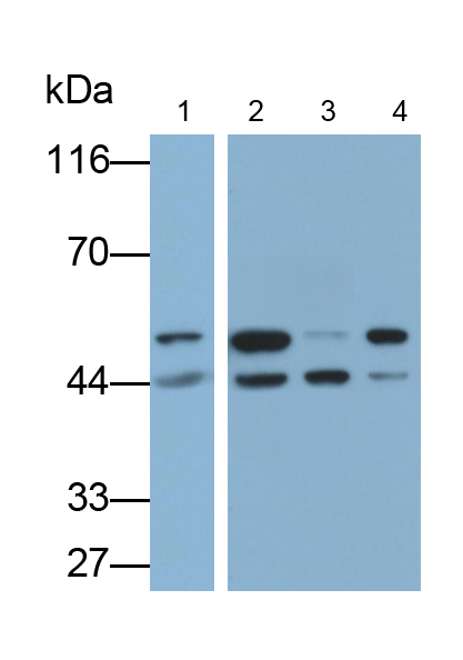 Polyclonal Antibody to Galectin 8 (GAL8)