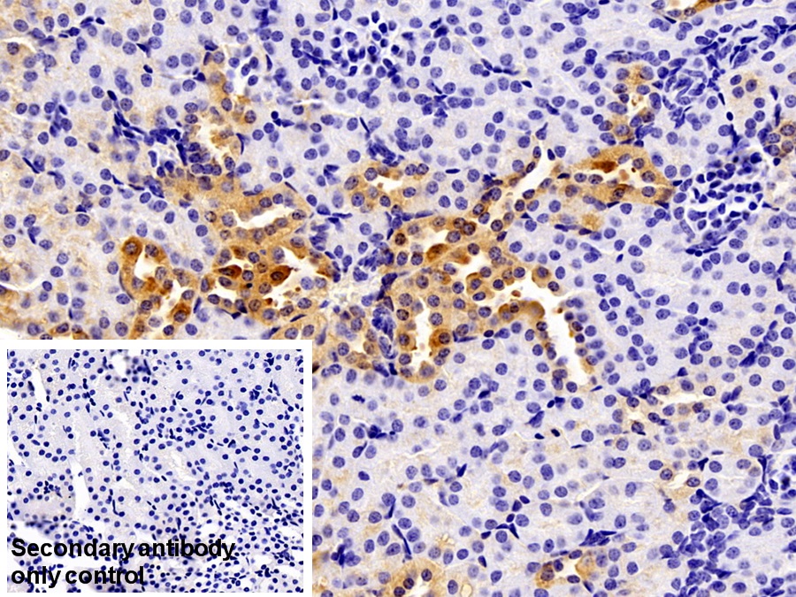 Polyclonal Antibody to Galectin 9 (GAL9)