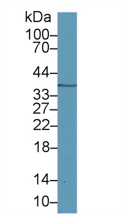 Polyclonal Antibody to Galectin 12 (GAL12)