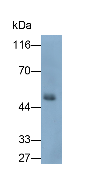 Polyclonal Antibody to Damage Specific DNA Binding Protein 2 (DDB2)
