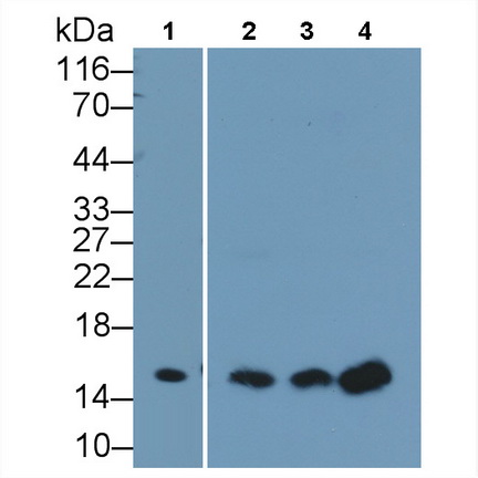 Polyclonal Antibody to Galectin 1 (GAL1)