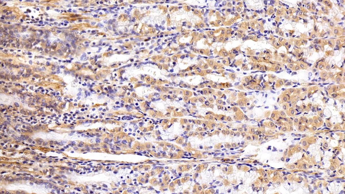 Polyclonal Antibody to Galectin 1 (GAL1)