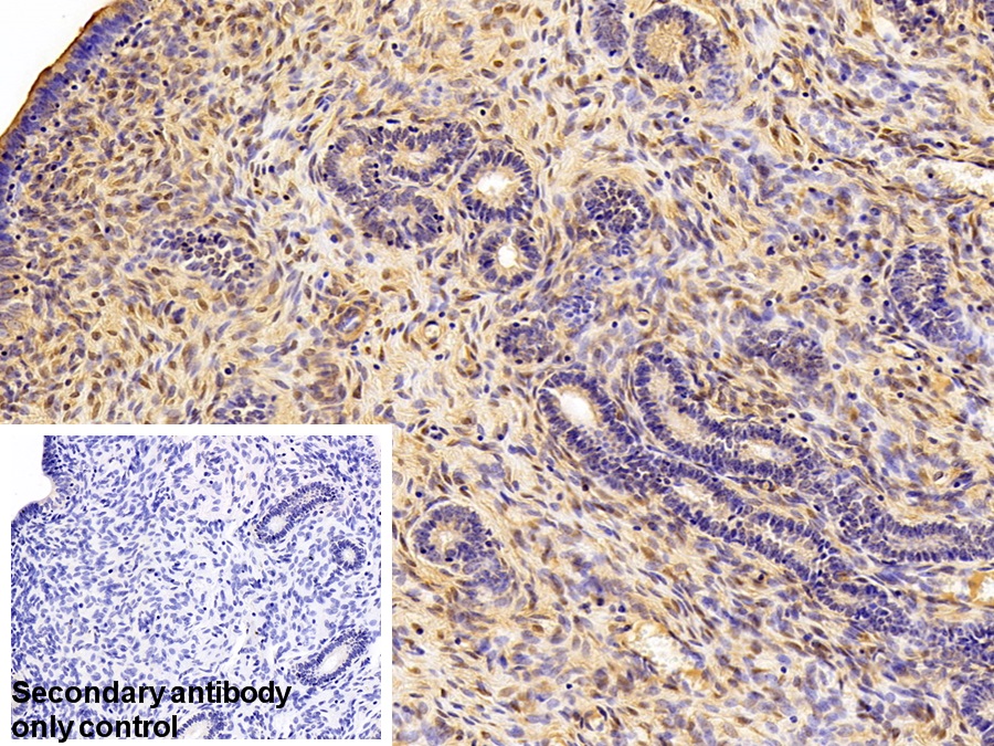 Polyclonal Antibody to Galectin 1 (GAL1)