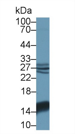 Polyclonal Antibody to Galectin 1 (GAL1)