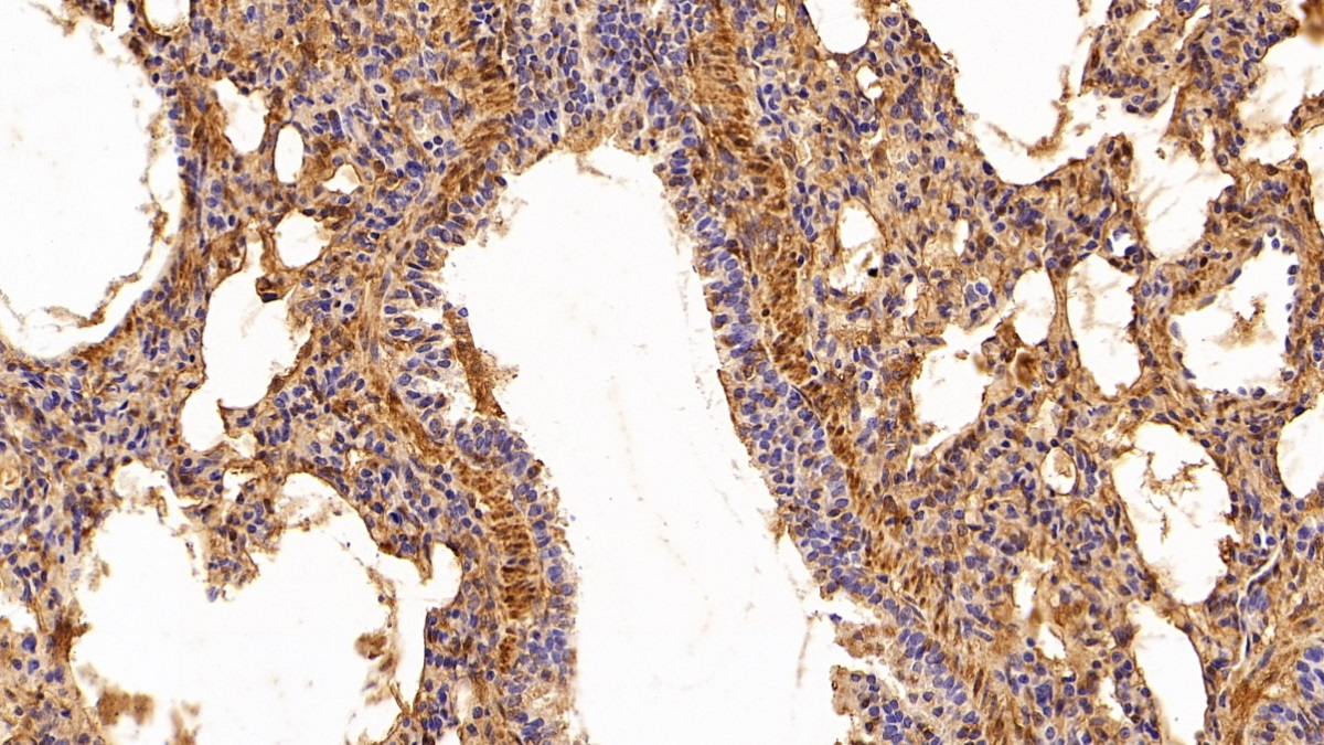 Polyclonal Antibody to Galectin 1 (GAL1)