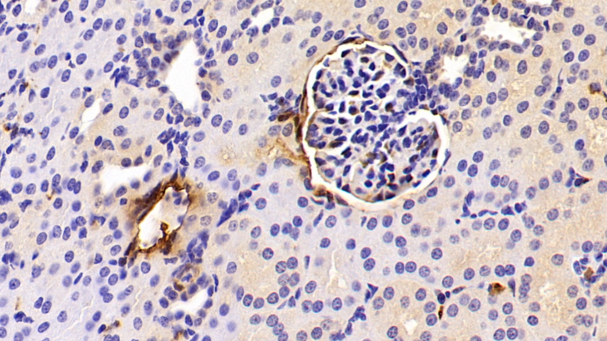 Polyclonal Antibody to Galectin 1 (GAL1)