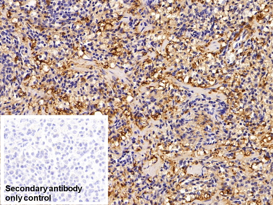 Polyclonal Antibody to Galectin 1 (GAL1)