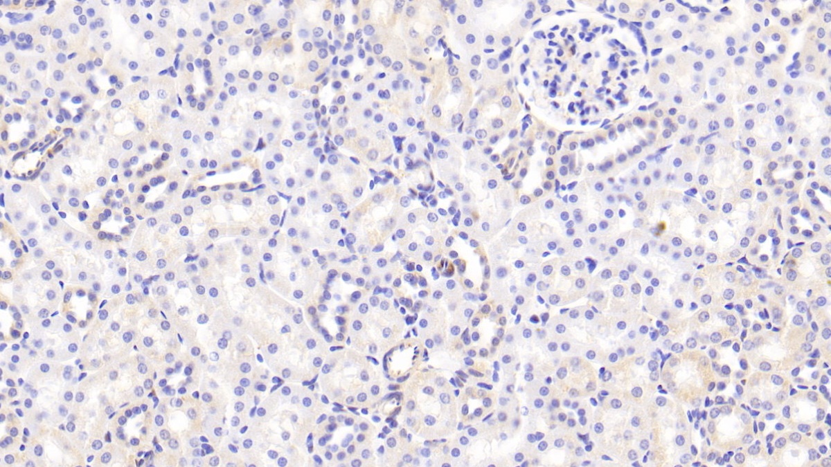 Polyclonal Antibody to Galectin 1 (GAL1)