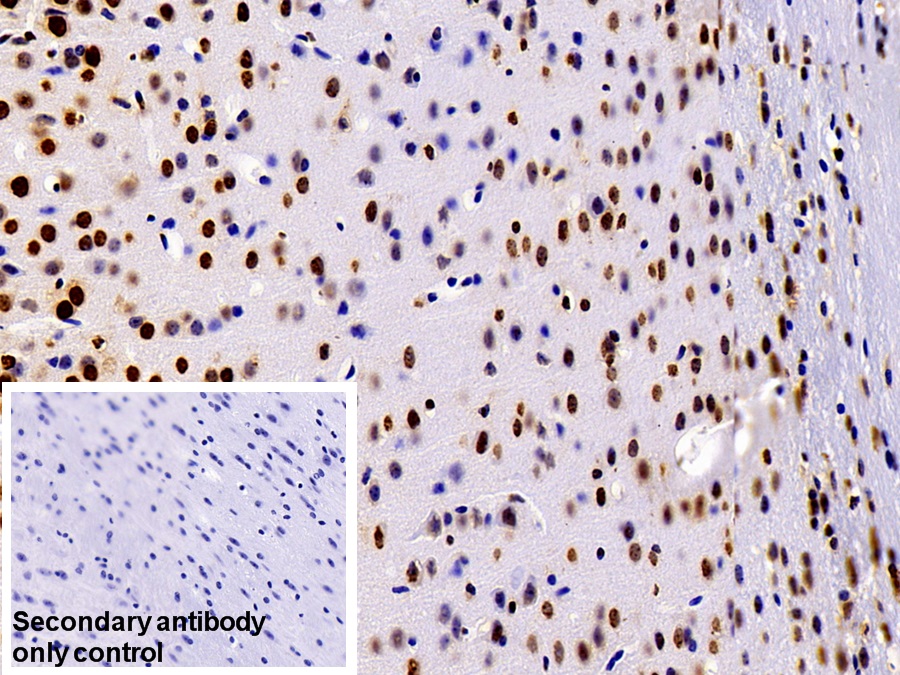 Polyclonal Antibody to Heterogeneous Nuclear Ribonucleoprotein A2/B1 (HNRPA2B1)