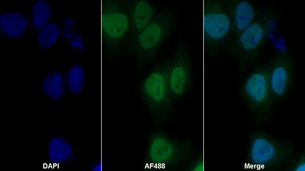 Polyclonal Antibody to Heterogeneous Nuclear Ribonucleoprotein A2/B1 (HNRPA2B1)