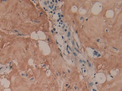 Polyclonal Antibody to Collagen Type I Alpha 1 (COL1a1)