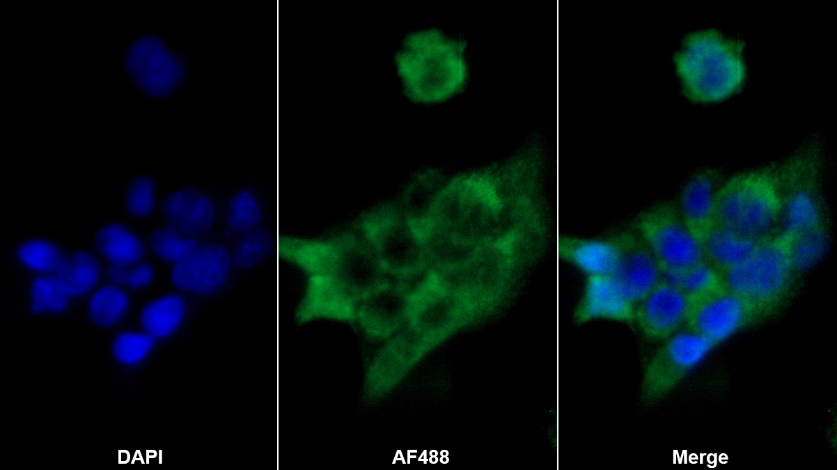 Polyclonal Antibody to Acyl Carrier Protein, Mitochondrial (ACP)