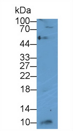 Polyclonal Antibody to Interferon Gamma Induced Protein 10kDa (IP10)