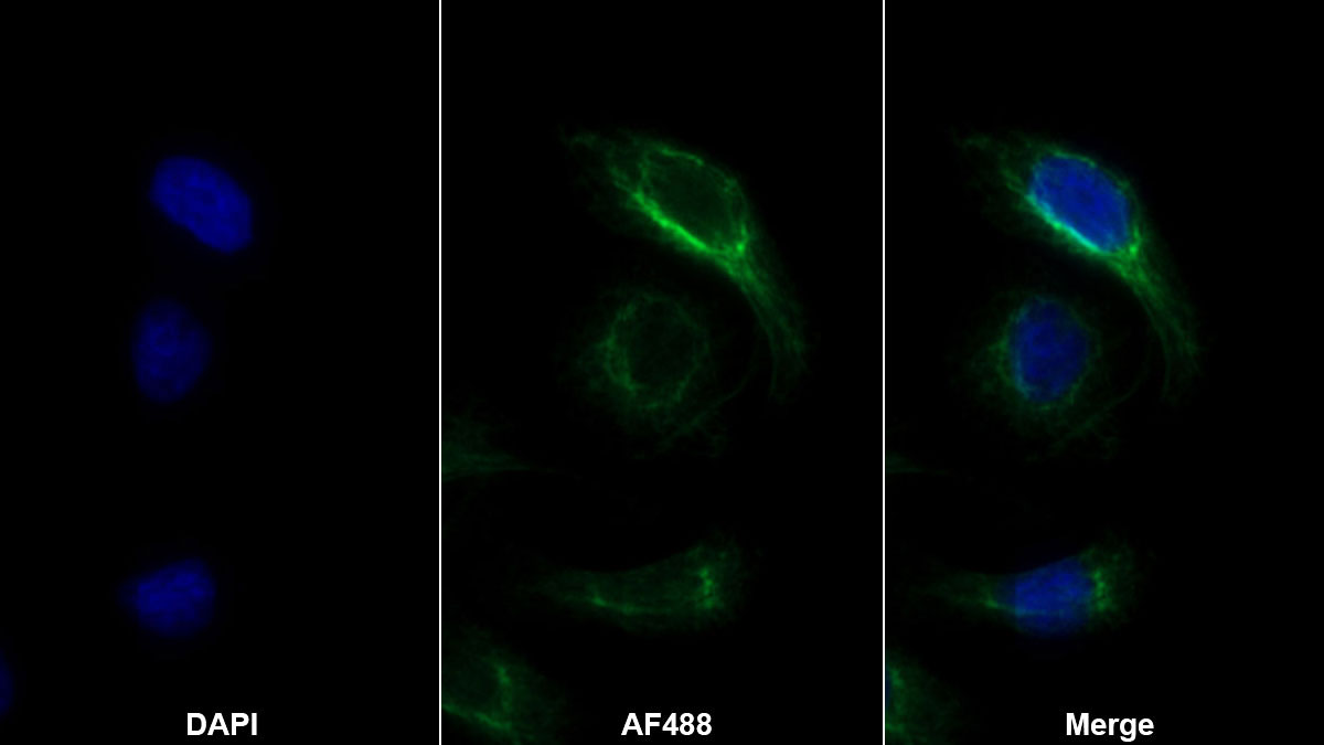 Polyclonal Antibody to Gelsolin (GSN)