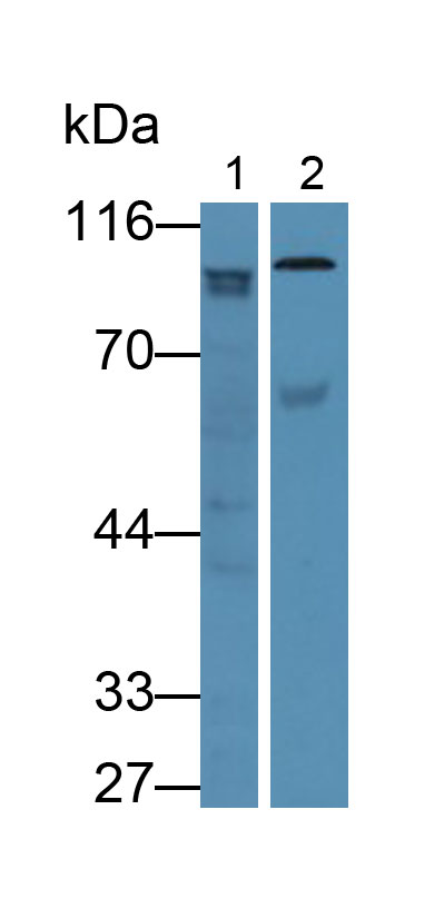 Polyclonal Antibody to Gelsolin (GSN)