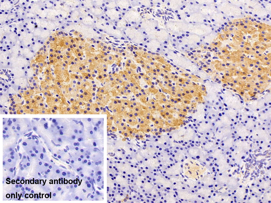 Polyclonal Antibody to Gelsolin (GSN)