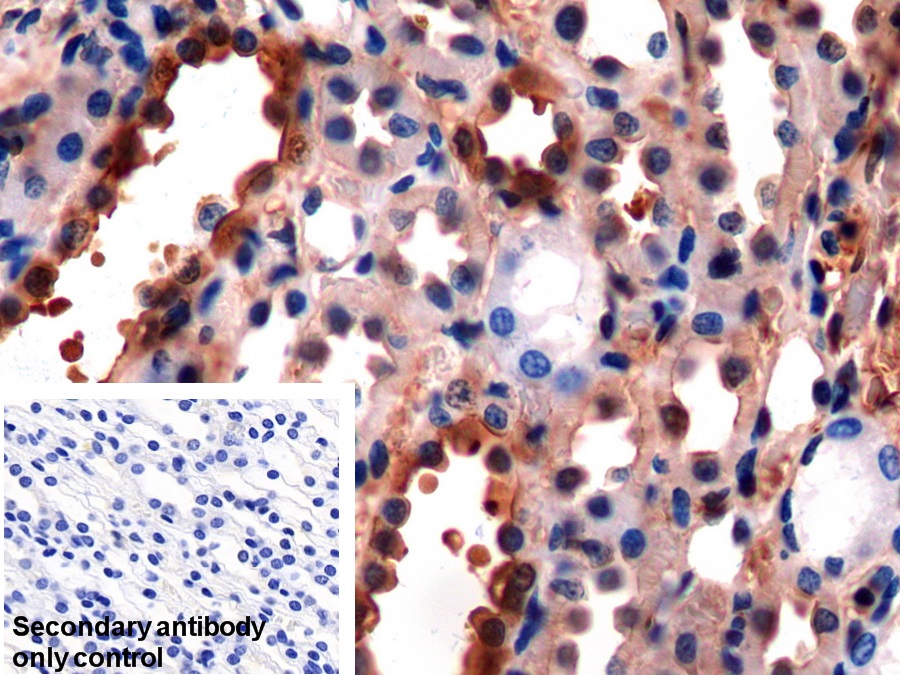 Polyclonal Antibody to Gelsolin (GSN)