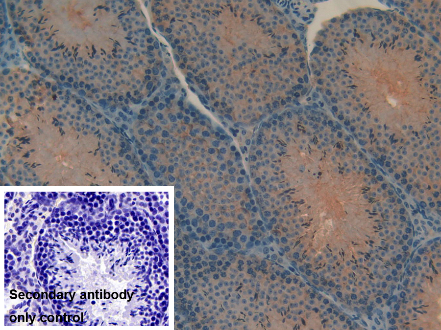 Polyclonal Antibody to Myosin IA (MYO1A)