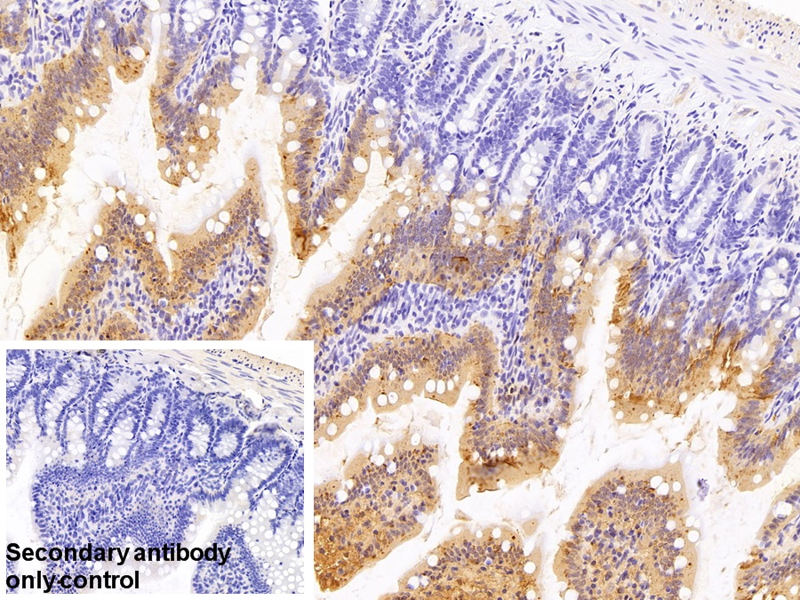 Polyclonal Antibody to Retinol Binding Protein 2, Cellular (RBP2)