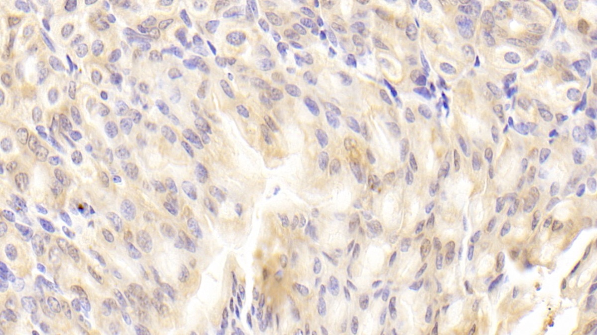 Polyclonal Antibody to Retinol Binding Protein 2, Cellular (RBP2)