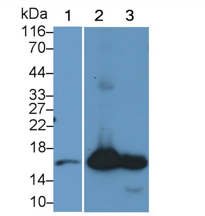 Polyclonal Antibody to Retinol Binding Protein 2, Cellular (RBP2)