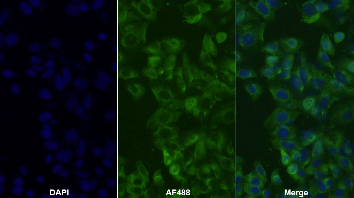Polyclonal Antibody to Retinol Binding Protein 2, Cellular (RBP2)
