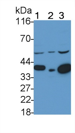 Polyclonal Antibody to Protein Kinase B Gamma (PKBg)