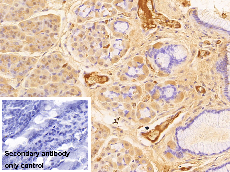 Polyclonal Antibody to Complement Component 3a (C3a)