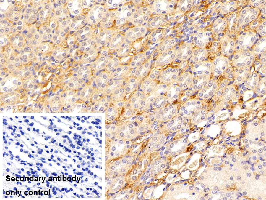 Polyclonal Antibody to Complement Component 3a (C3a)