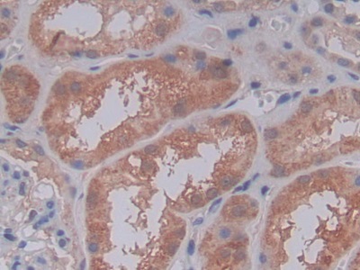 Polyclonal Antibody to Complement Component 5a (C5a)