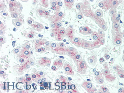 Polyclonal Antibody to Complement Component 5a (C5a)