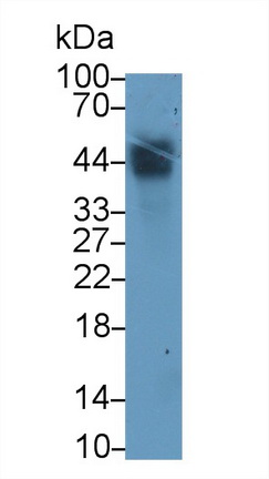 Polyclonal Antibody to Tissue Factor Pathway Inhibitor (TFPI)