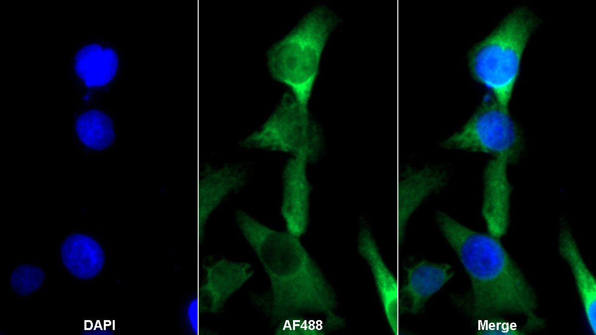 Polyclonal Antibody to Sex Hormone Binding Globulin (SHBG)