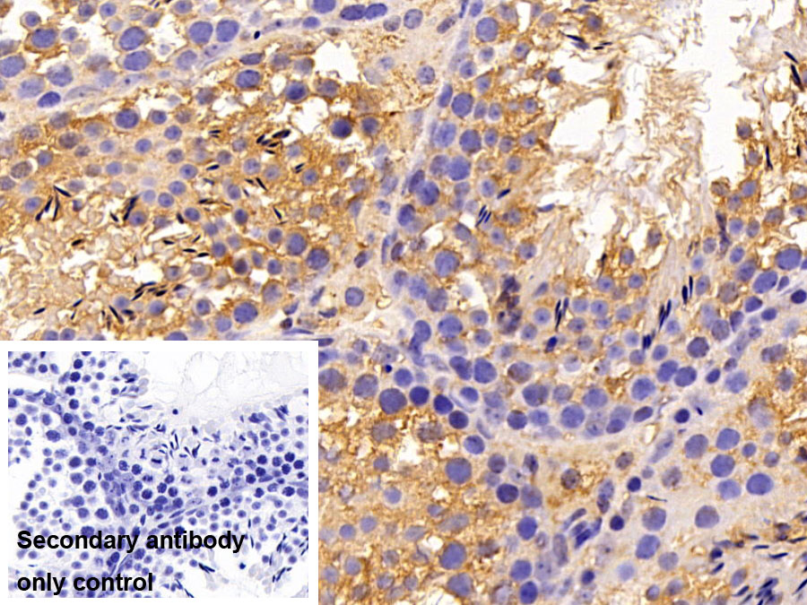 Polyclonal Antibody to Sex Hormone Binding Globulin (SHBG)