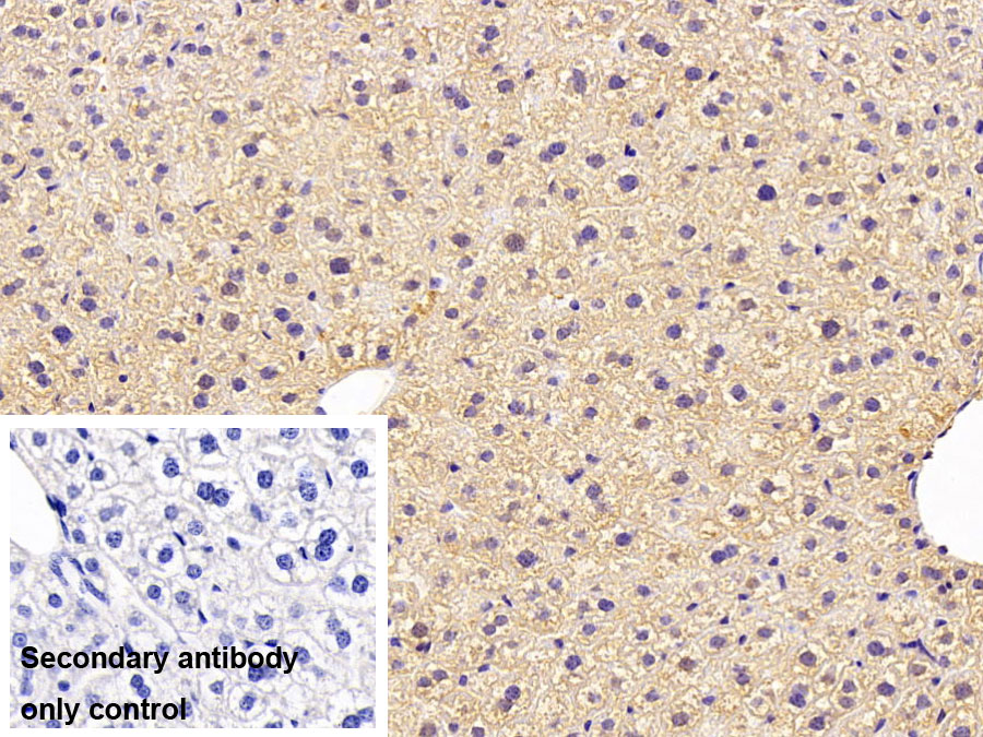 Polyclonal Antibody to Sex Hormone Binding Globulin (SHBG)